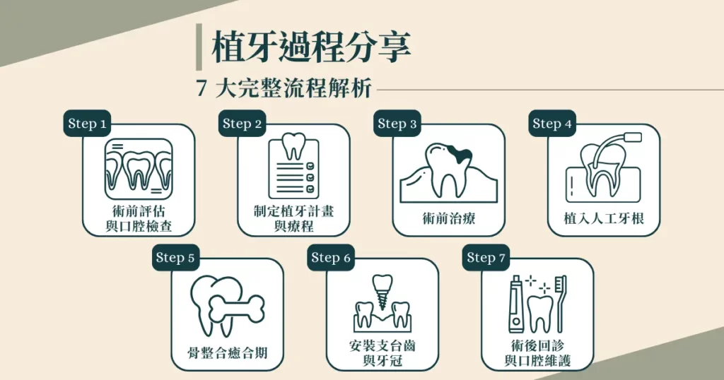 植牙過程分享｜ 7 大完整流程解析